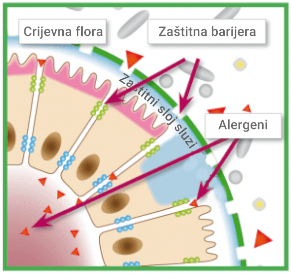Alergija